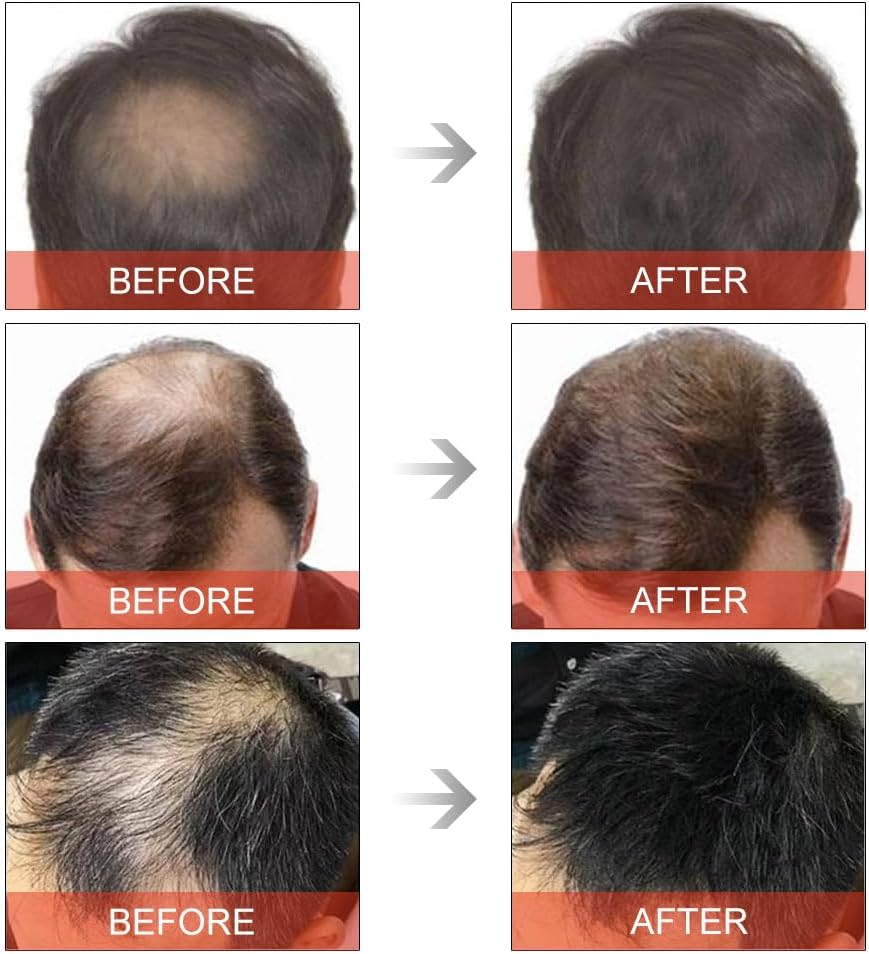 Hair Building Fibers - Natural Fibres for Men & Women, Waterproof & Instant Hair Loss Concealer - Black