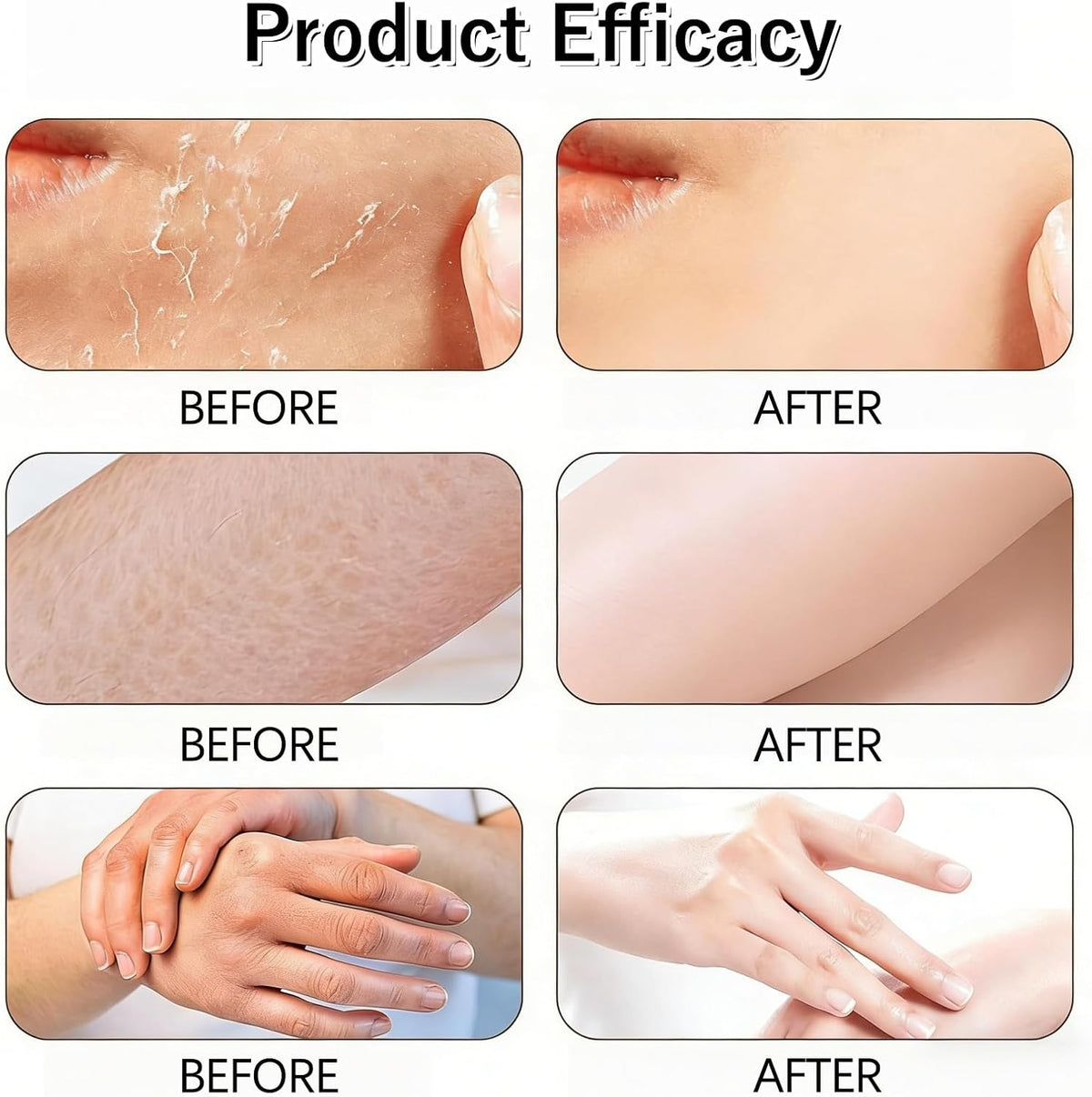 Glycolic Acid Exfoliating Body Stick, Gentle Exfoliating Body Scrub Stick, Glycolic Acid Body Scrub, Body Scrub & Exfoliator for Smooth Skin, Improves Skin Texture & Brightnes, Body Exfoliator