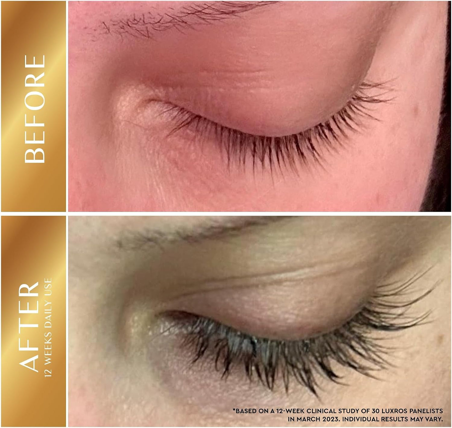 Eyelash Growth Serum 5 mL: Get Thick, Strong Lashes in Just 3-4 Weeks with Our Plant-Based Eyelash Enhancer Serum - No Parabens - Made in USA