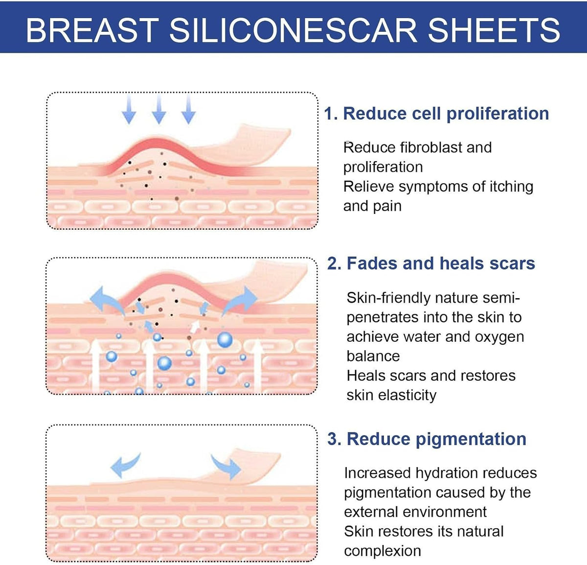 silicone scar sheets for breast scar removal, soft bands for areola, silicone anchor bands, surgical burn therapy