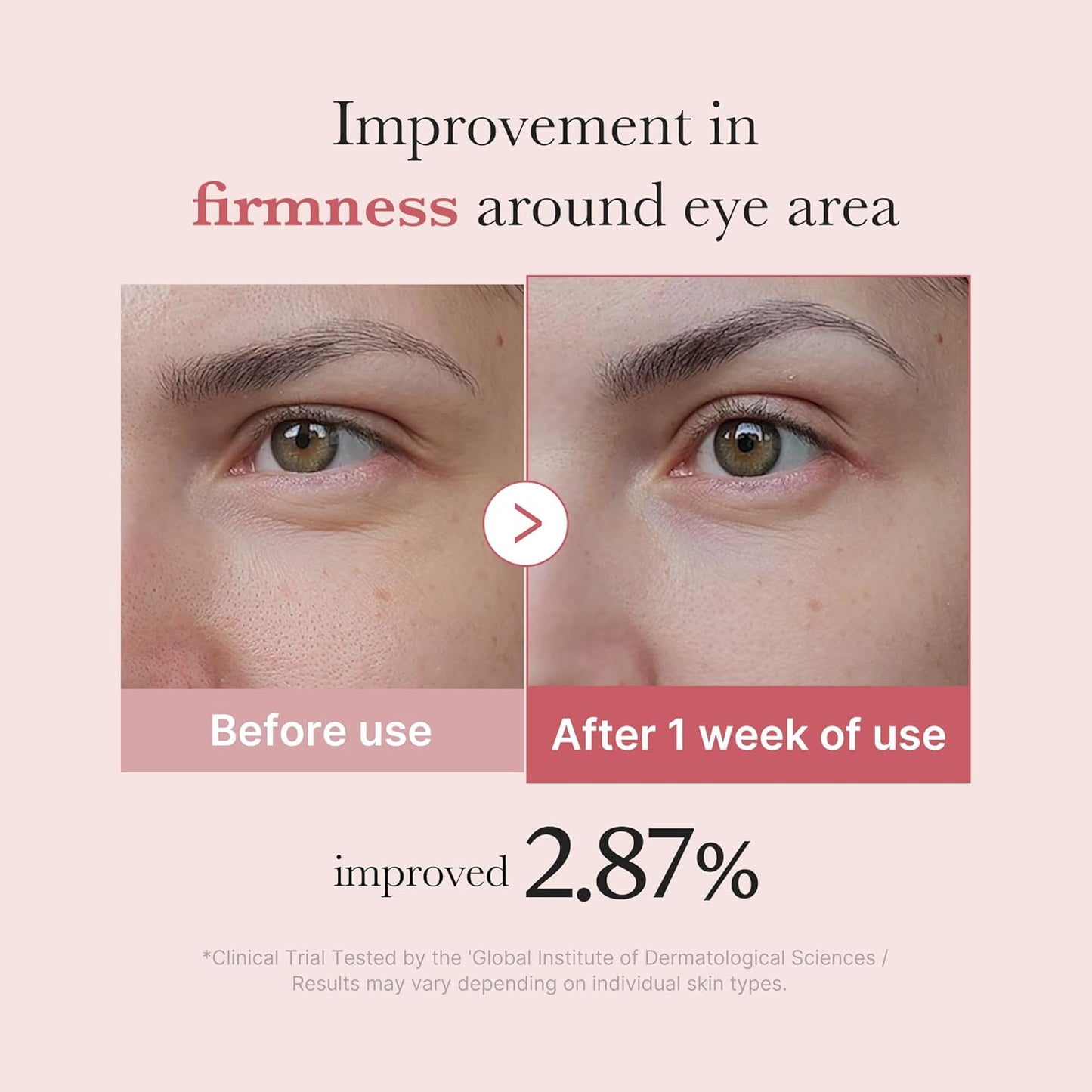 medicube Eye Cream with Salmon DNA PDRN & Pink Peptides | 99% Purity Retinol for Fine Lines | PDRN & Niacinamide Eye Serum for Uneven Skin Tone | Korean Skincare, 1.01 fl.oz