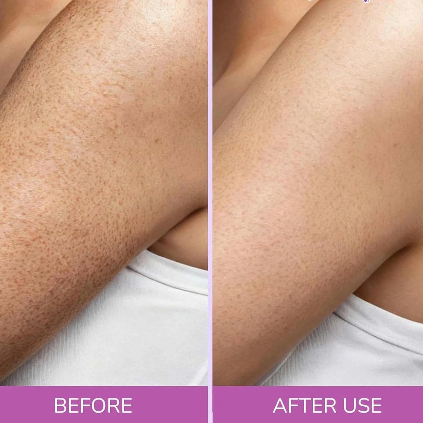 1PCS Glycolic Acid Exfoliating Body Stick, with 7% Glycolic & 0.5% Salicylic Acid, AHA BHA Formula for Rough Skin, Keratosis Pilaris, Dark Spots & Dry Patches Care