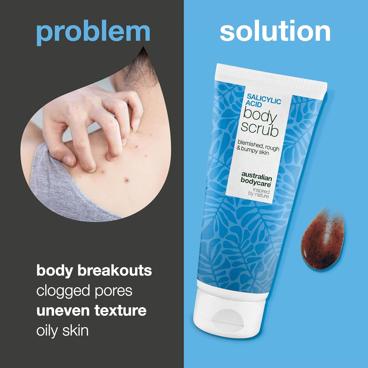 Salicylic Acid Body Exfoliator Scrub for Spots on Back, Bum and Chest – Removes Impurities and Unclogs Pores with Glycolic Acid and Apricot Seed – BHA & AHA Peeling