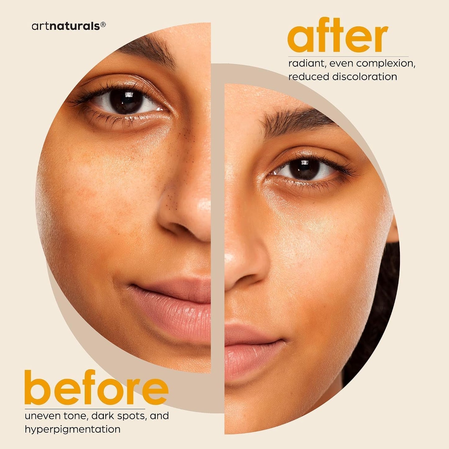 Kojic Acid Soap + African Net Sponge (2 pack X 142g Turmeric bars) Dark spot remover, Hyperpigmentation & Scars - Original Japanese Complex Vitamin C, Hyaluronic Acid, retinol, shea butter (Citrus)