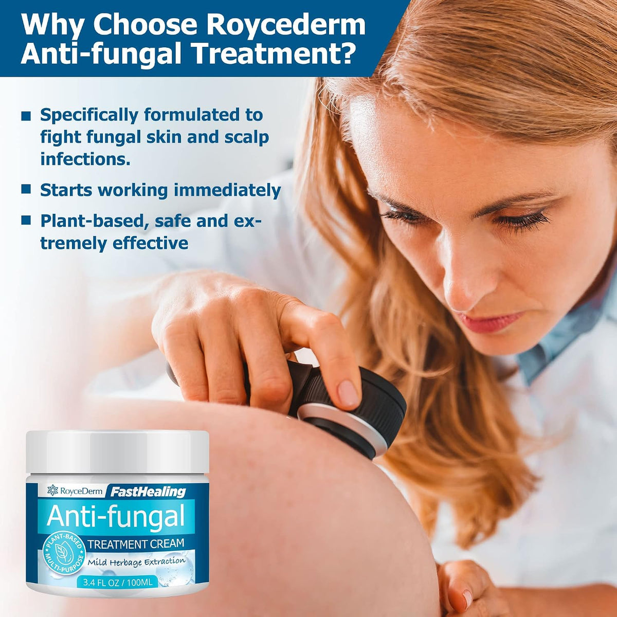 Roycederm Antifungal Treatment Cream for Skin: Anti-Fungal Cream for Jock Itch, Ringworm, Athlete's Foot & Rash Relief - Strong Fungal Care for Men & Women - Gentle Formula for Itchy Skin & Tinea