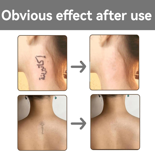Waterproof Body Concealer&amp;Leg Foundation Full Coverage,High Coverage Body Makeup Waterproof Foundation Effectively Covers Tattoos,Scars,Varicose Veins,Waterproof&amp;Sweat-Resistant for All Skin Tones