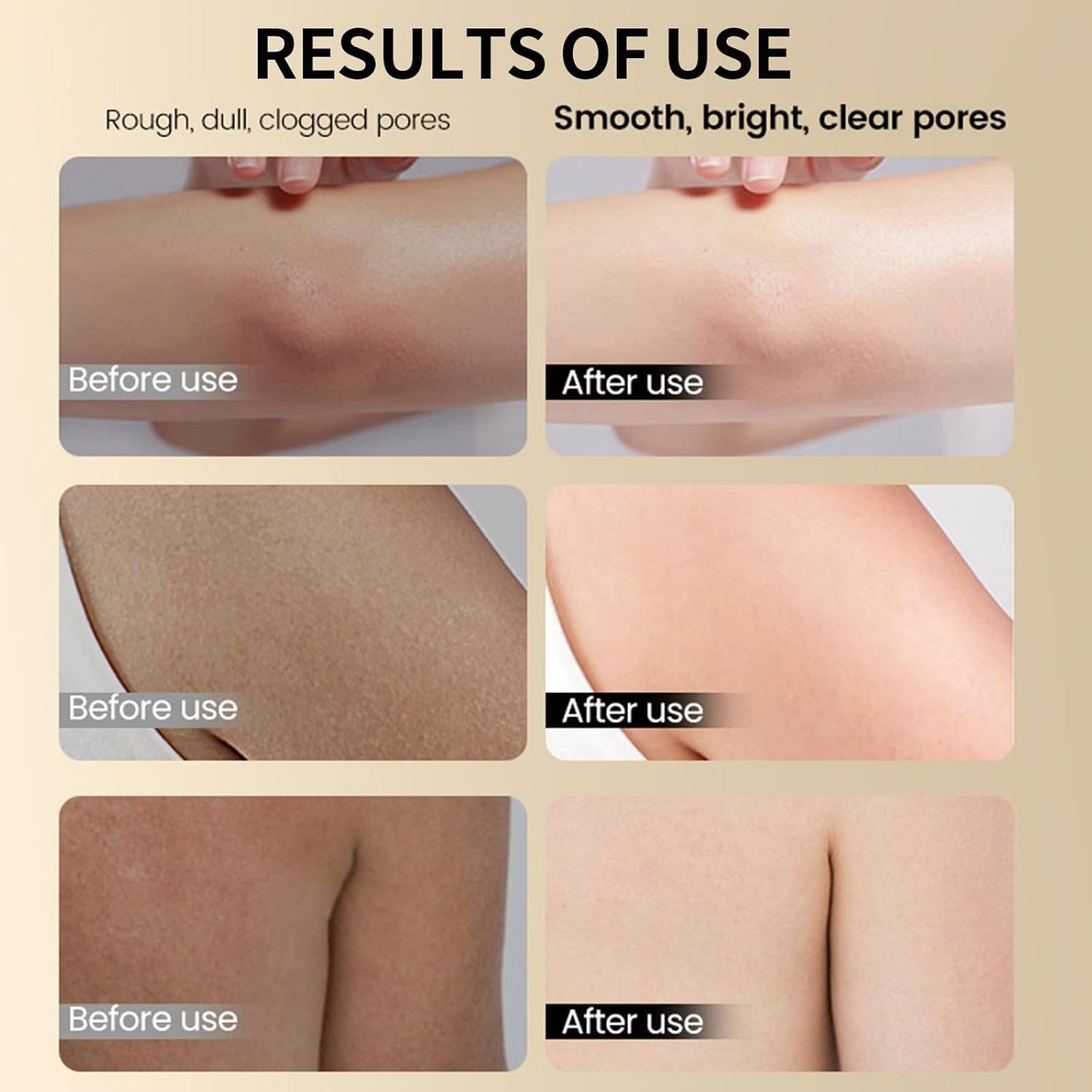 Glycolic Acid Exfoliating Body Stick, Glycolic Acid Stick for Gentle Exfoliation, Smooths Rough Texture, Boosts Radiant Glow, Body Care Balm for Underarms Legs &amp; Full Body, 2.65 Oz