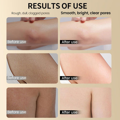 Glycolic Acid Exfoliating Body Stick, Glycolic Acid Stick for Gentle Exfoliation, Smooths Rough Texture, Boosts Radiant Glow, Body Care Balm for Underarms Legs &amp; Full Body, 2.65 Oz