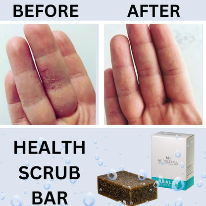 Tea Tree Oil Soap Anti-Fungal Antibacterial for Sweat Rash Ring worm Body Odour Yeast Exfoliating Natural Cleanser Acne Athletes Foot Healthy Feet Skin Nails Marble Hill Health Scrub Bar 100g