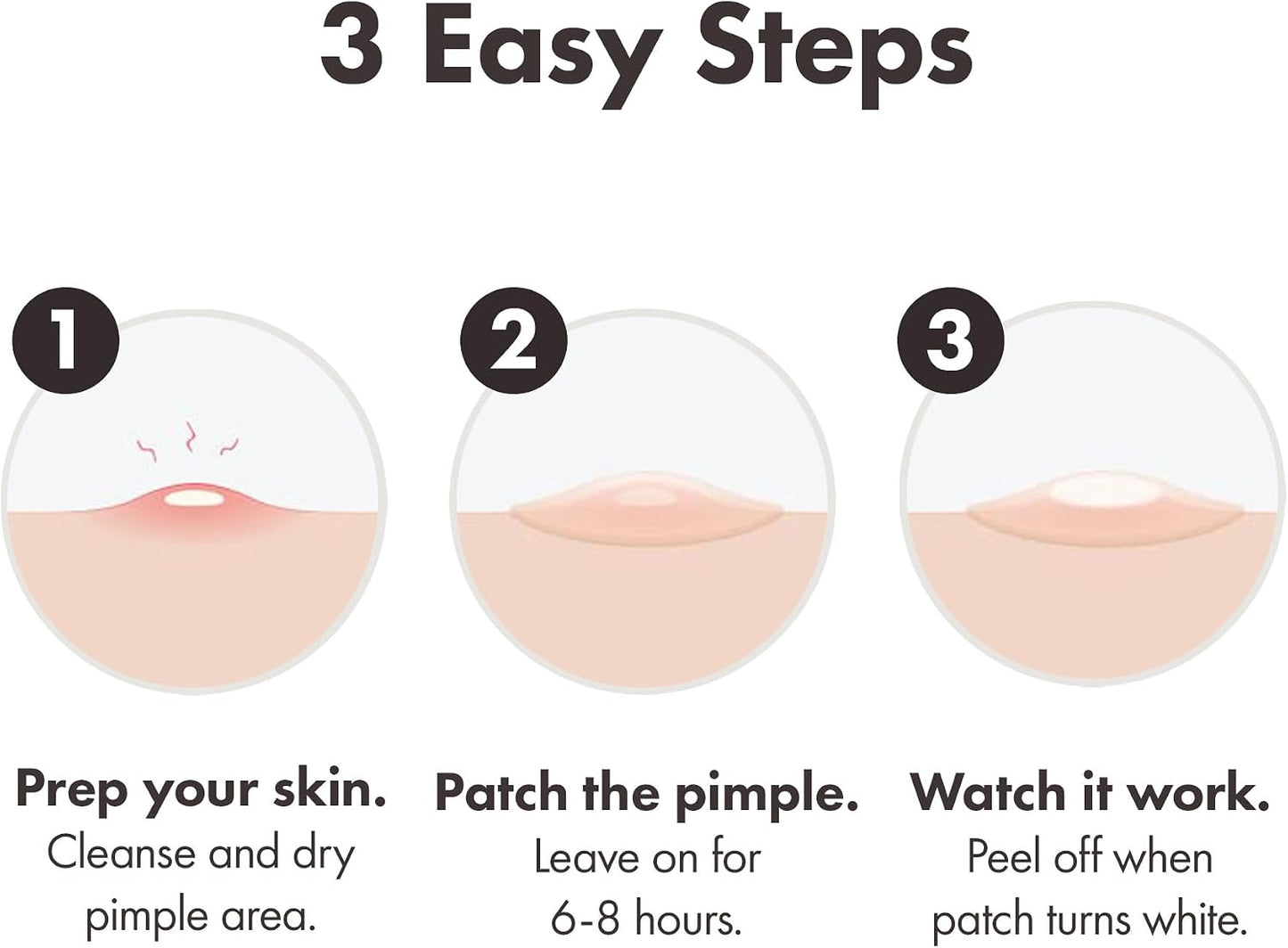 Mighty Patch: the unobtrusive side‑kick for breakout days
