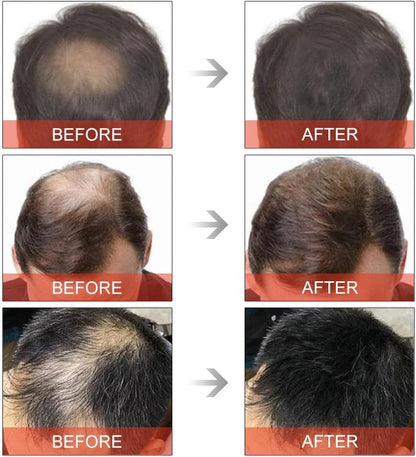 Hair Building Fibers - Natural Fibres for Men &amp; Women, Waterproof &amp; Instant Hair Loss Concealer - Black