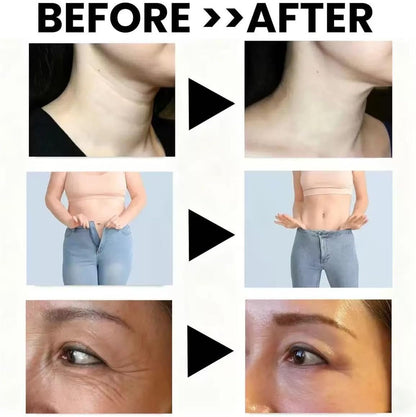 6-in-1 Lymph Complex, Firms Skin, Fights Inflammation, Eliminates Bloating | Gluten-Free - Non-GMO - Vegan