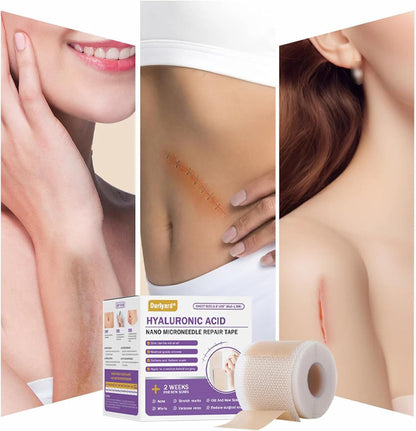 Bostore Hyaluronic Acid Nano Microneedle Repair Tape, Hyaluronic Acid Nano Repair Tape, Bostore Repair Tap, Extra Long Silicone Scar Sheets, Gentle and Skin-Friendly, Daily Care (4pcs)