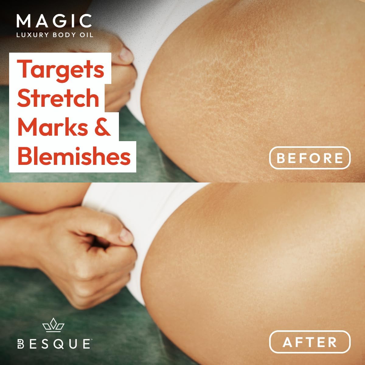 Besque Magic Body Oil, 100ml, After Shower Body Oil For Women, Hydrating Skin Care For Full Body That Plumps, Tightens, and Firms Skin With Natural Ingredients, Made In UK