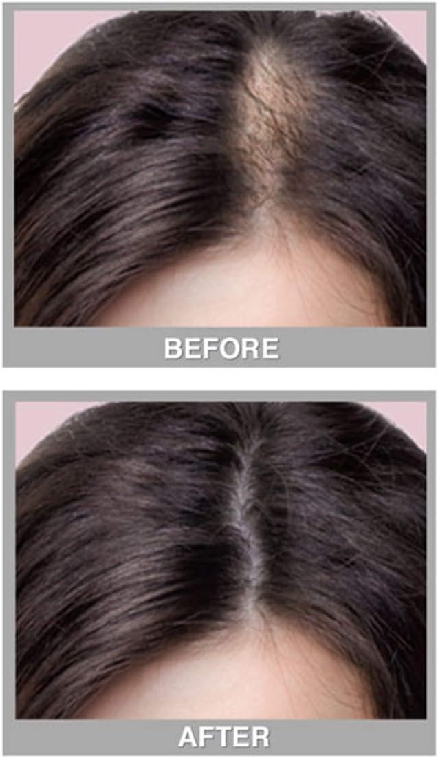 Fill-in with Procapil, Powder, Brown, Medium