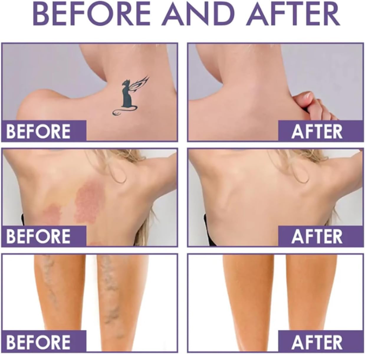 Leg Makeup - Body Coverage Perfector,All Over Complexion Perfector,Tattoo Cover Up Cream,Waterproof Long-Lasting Sweat-Proof Concealer (#3)
