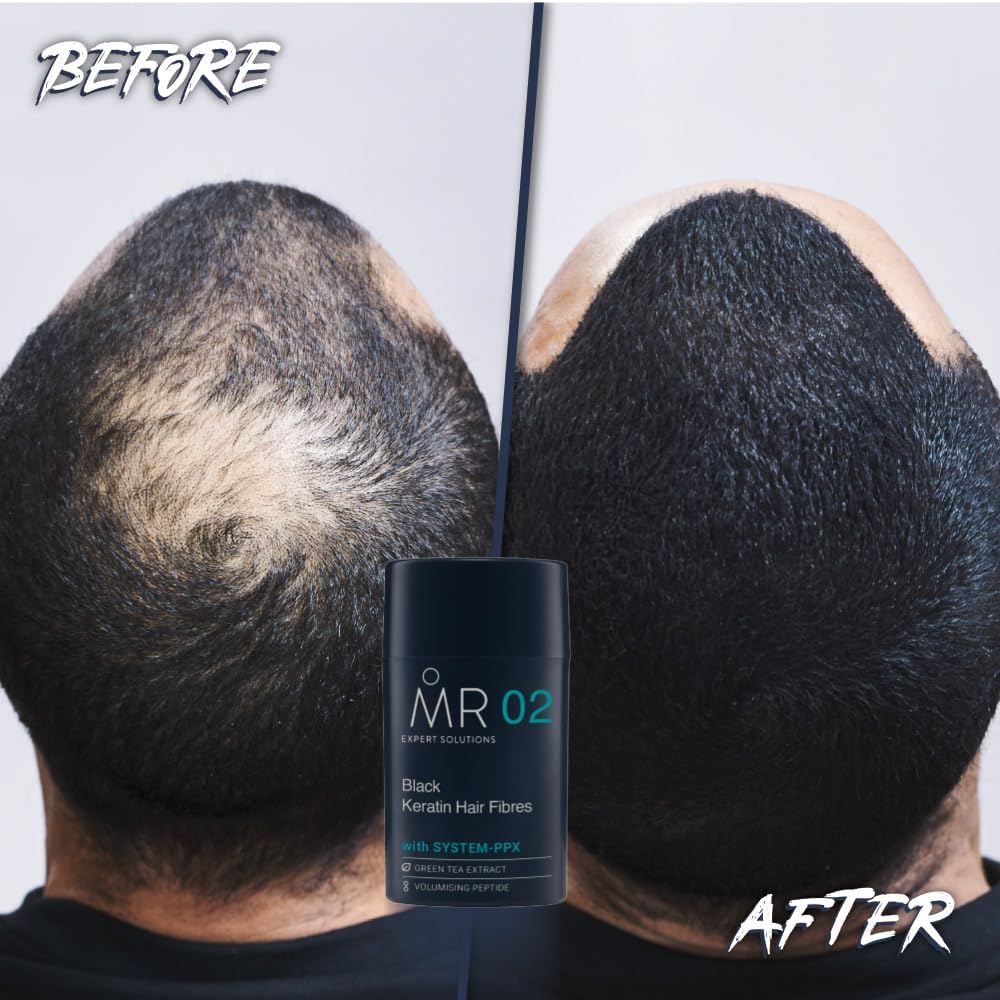 MR Hair Fibres Black 15g – Thinning Hair Concealer for Men, Instant Thickening Powder for Bald Patches, Natural Fuller Look, Keratin Formula, Paraben Free