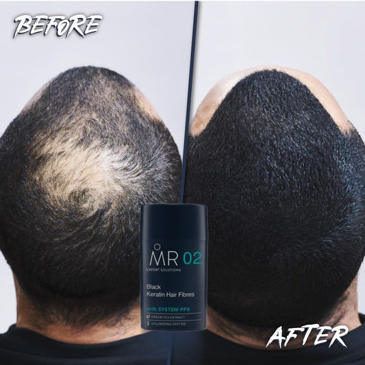 MR Hair Fibres Black 15g – Thinning Hair Concealer for Men, Instant Thickening Powder for Bald Patches, Natural Fuller Look, Keratin Formula, Paraben Free