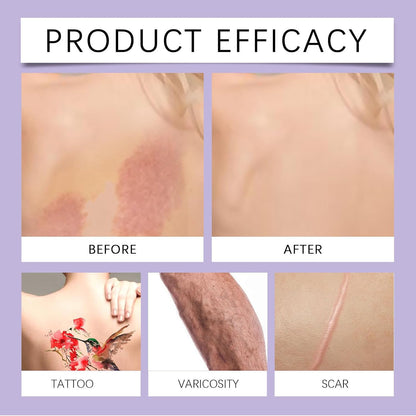 Waterproof Leg Makeup to Cover Veins - Full Coverage Tattoo Cover Up No Transfer Body Makeup - Body Concealer for Mature Skin - Natural Long Lasting Scar CoverUp Makeup for All Skin Tones,No Transfer
