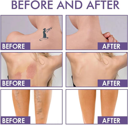 Body Coverage Perfector Waterproof with Brush, Full Coverage Tattoo Cover Up Cream, Leg and Body Makeup for Women, Long Lasting Leg Foundation for Daily Wear
