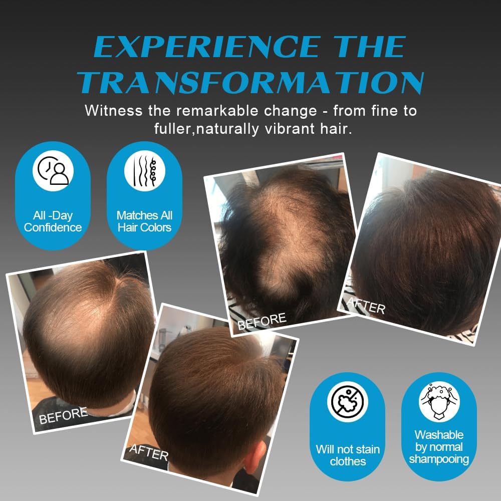 Hair Fibres DARK BROWN for Thinning Hair, Natural Keratin Hair Fibres for men &amp; Women for Instant Result, Concealer for Thicker, Fuller Hair, Undetectable &amp; Secure, Premium Long-Lasting Hold (28g)