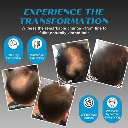 Hair Fibres DARK BROWN for Thinning Hair, Natural Keratin Hair Fibres for men &amp; Women for Instant Result, Concealer for Thicker, Fuller Hair, Undetectable &amp; Secure, Premium Long-Lasting Hold (28g)