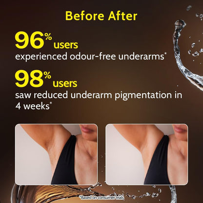 Chemist at Play AHA Underarm Roll-On | Woody Musk| Brighter &amp; Even Toned Underarm &amp; Body | 5% AHAs &amp; Vitamin C | For Dark Underarms | Women &amp; Men