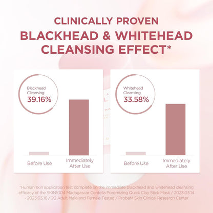 Centella Asiatica Pore Refining Mud Mask, 27g/0.95oz - Clinically proven to effectively cleanse blackheads and whiteheads, leaving skin smooth and refined with minimized pores after just one use.