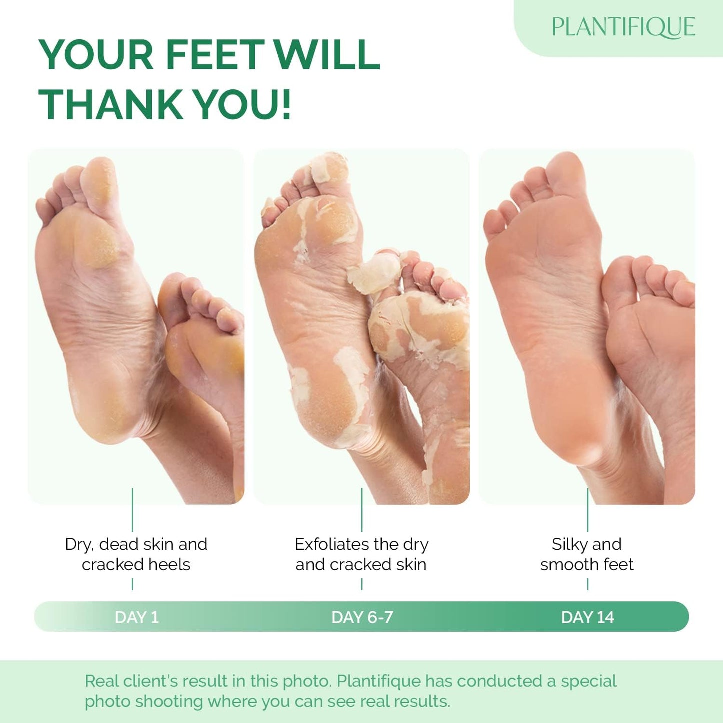 Soft‑Foot Solution You Can Slip On