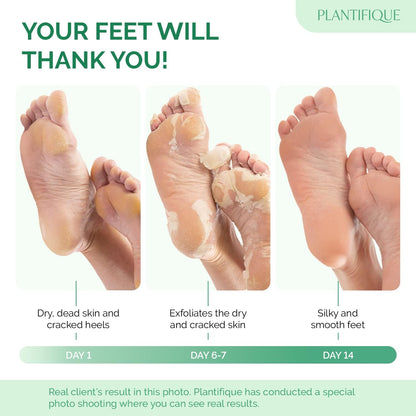 Soft‑Foot Solution You Can Slip On