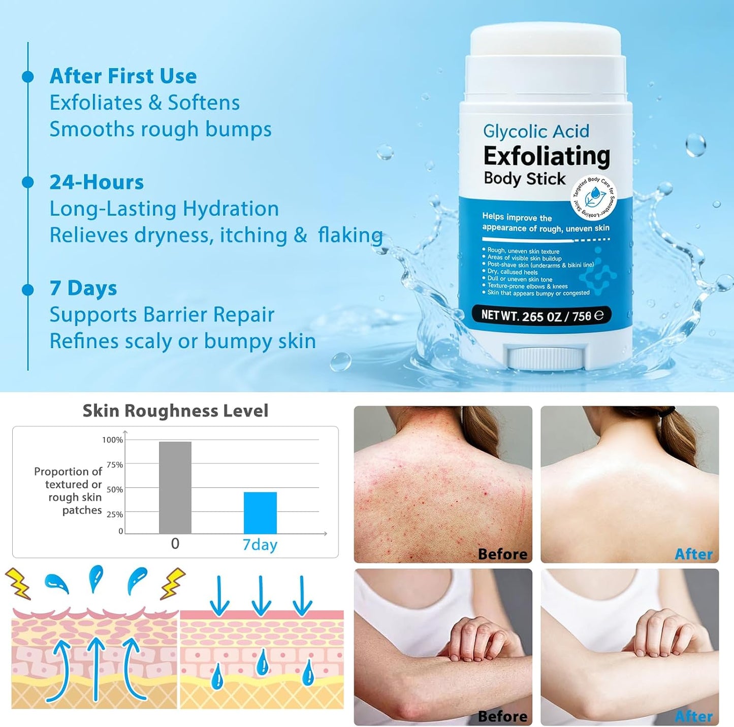 Glycolic Acid Exfoliating Body Stick &amp; Cream, Gentle Exfoliating Body Scrub Stick, Smooths Rough Skin,Reduces the Appearance of Cellulite— For Arms, Legs, Inner Thighs, Underarms &amp; Rough Areas, 2.65 O