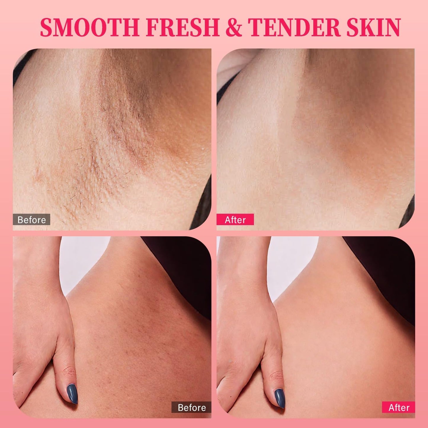 Bikini Exfoliating Scrub with 10% AHA + BHA &amp; Vitamin C, Exfoliating Body Scrub for Ingrown Hair and Underarm Bumps, Dark Spots, Moisturize Brighten Soothe &amp; Even Skin Tone, Sensitive Skin Safe,220g