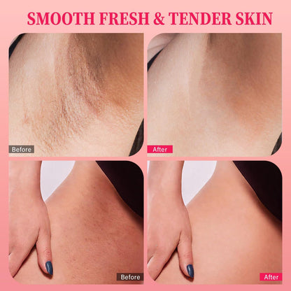 Bikini Exfoliating Scrub with 10% AHA + BHA &amp; Vitamin C, Exfoliating Body Scrub for Ingrown Hair and Underarm Bumps, Dark Spots, Moisturize Brighten Soothe &amp; Even Skin Tone, Sensitive Skin Safe,220g