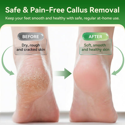 Why the ShoRan Electric Foot File is Becoming a Bathroom Staple