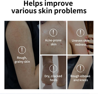 Glycolic Acid Exfoliating Body Stick, Gentle Daily Body Scrub &amp; Exfoliator for Smooth Skin, Improves Texture &amp; Brightness, Easy-to-Use Body Skin Care