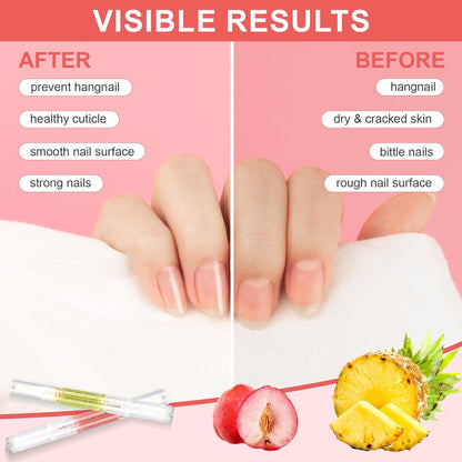 Why a Tiny Cuticle Oil Pen Might Just Be Your New Nail‑Care BFF