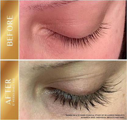 Eyelash Growth Serum 5 mL: Get Thick, Strong Lashes in Just 3-4 Weeks with Our Plant-Based Eyelash Enhancer Serum - No Parabens - Made in USA