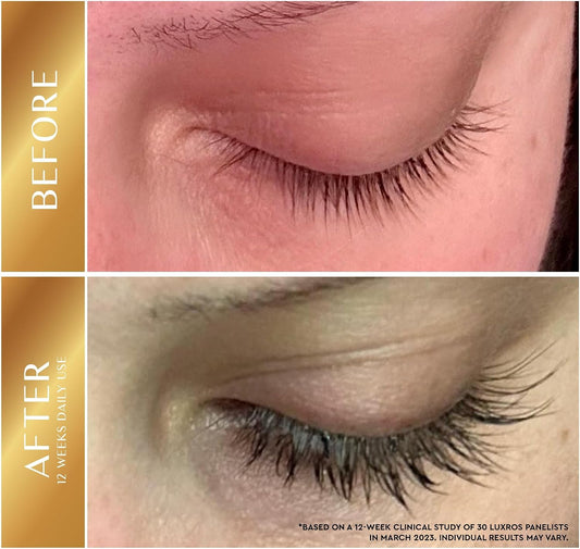 Eyelash Growth Serum 5 mL: Get Thick, Strong Lashes in Just 3-4 Weeks with Our Plant-Based Eyelash Enhancer Serum - No Parabens - Made in USA