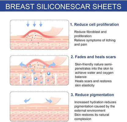 silicone scar sheets for breast scar removal, soft bands for areola, silicone anchor bands, surgical burn therapy