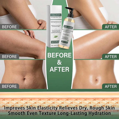2PCS Collagen Lifting Body Oil, 100ML Firming &amp; Moisturizing Massage Oil for Skin Tightening, Scar, Wrinkle, and Stretch Mark Repair, Full Body Use