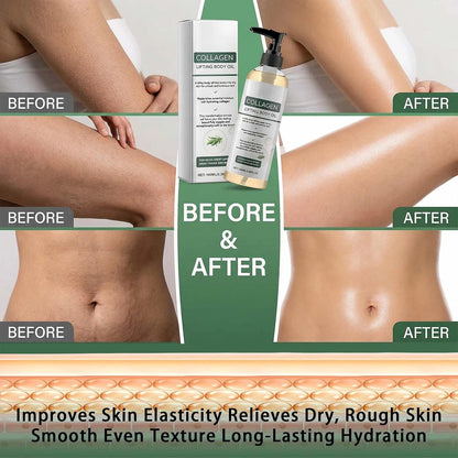 2PCS Collagen Lifting Body Oil, 100ML Firming &amp; Moisturizing Massage Oil for Skin Tightening, Scar, Wrinkle, and Stretch Mark Repair, Full Body Use