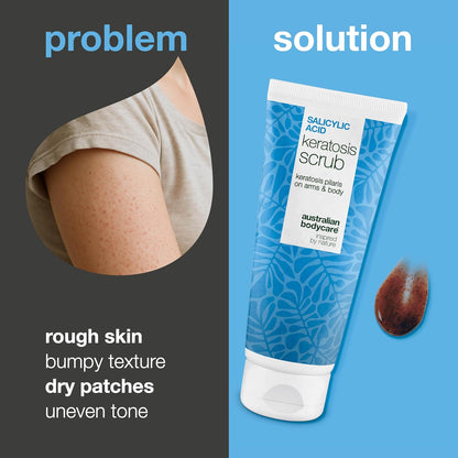 Keratosis Pilaris Body Scrub Treatment – Chemical (AHA/BHA) + Physical Exfoliant for Strawberry Legs, KP &amp; Ingrown Hair with Salicylic Acid, Glycolic Acid, Apricot Seed &amp; Allantoin