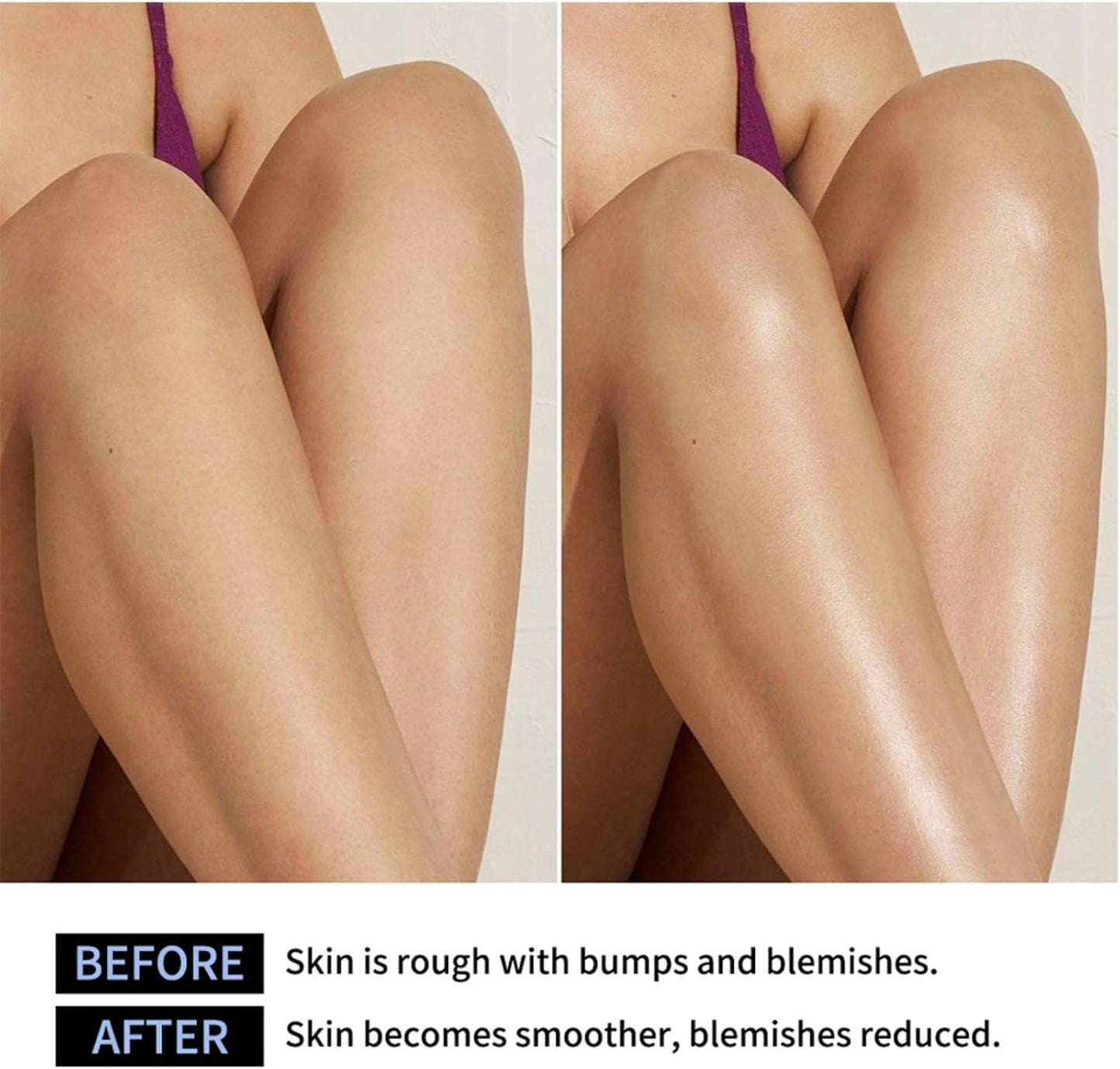 Exfoliating Body Stick with AHA 7% + BHA 0.5% – Solid Body Scrub for Smooth &amp; Soft Skin – Non-Messy Body Exfoliator with Shea Butter – For Arms, Legs, Underarms, Inner Thighs &amp; Rough Areas