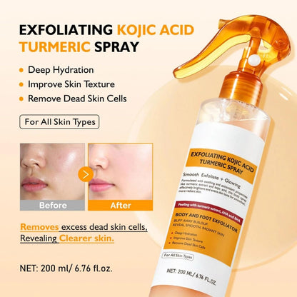 200ml Exfoliating Kojic Acid Turmeric Spray, Body Peel Shot SprayS, Face Peeling Kojic Acid Turmeric Spray, Turmerics Peel Shot Sprays, Gently Exfoliating Face &amp; Body Scrub for Smoother Skin