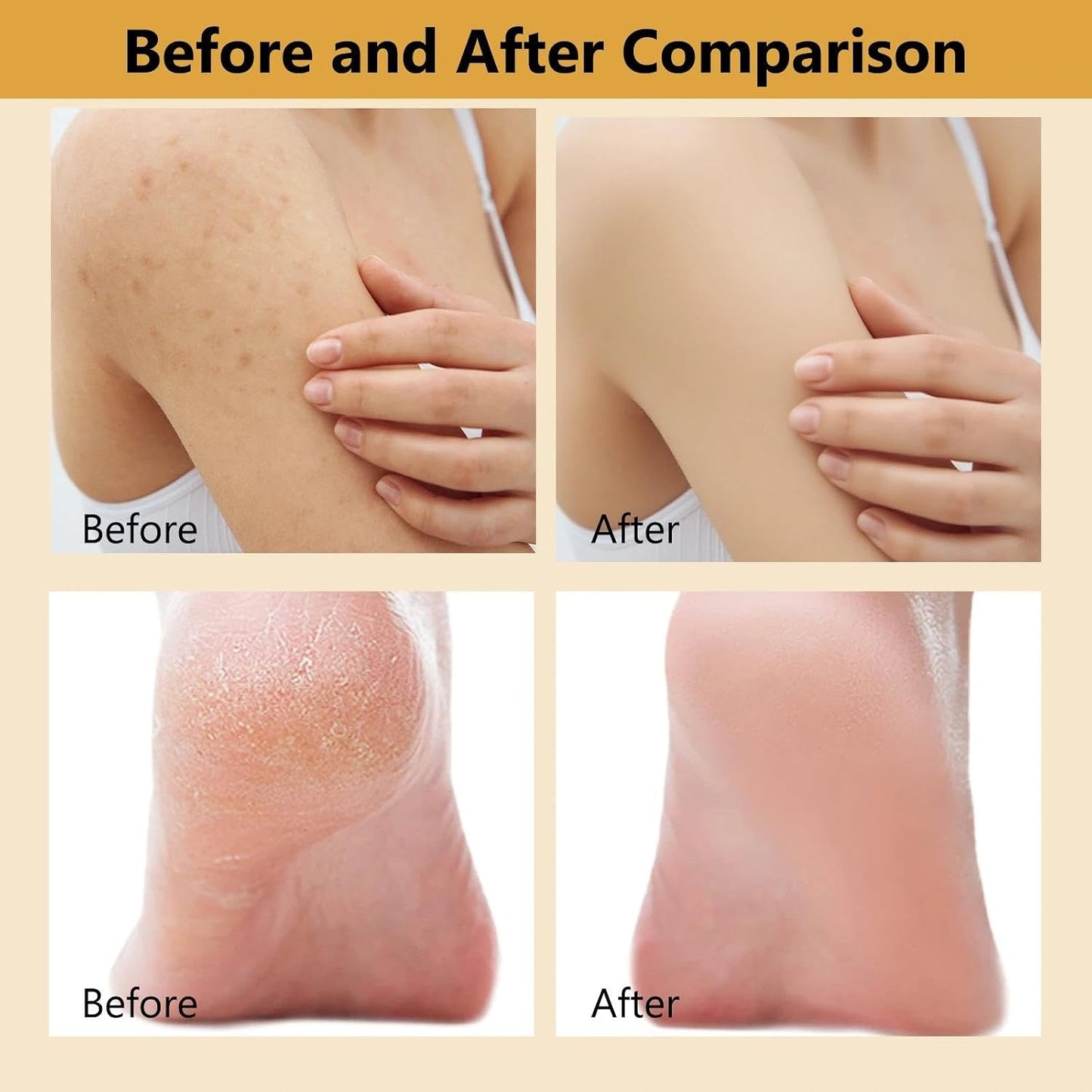 200ml Exfoliating Kojic Acid Turmeric Spray, Body Peel Shot SprayS, Face Peeling Kojic Acid Turmeric Spray, Turmerics Peel Shot Sprays, Gently Exfoliating Face &amp; Body Scrub for Smoother Skin