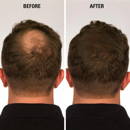 Eclipse Instant Hair Filler GREY 14 grams Shaker Top by Eclipse