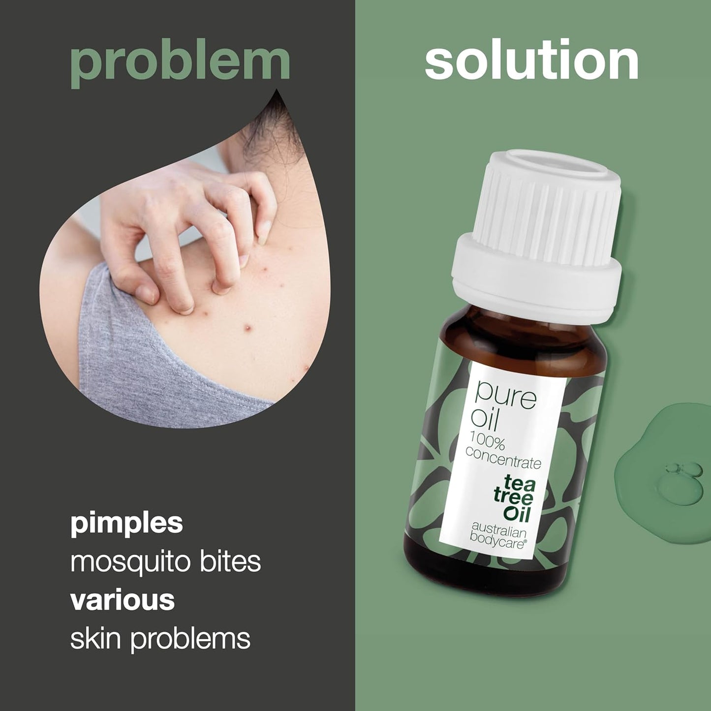 Australian Bodycare 100% Pure Tea Tree Oil, 10 ml | Our Tea Tree Oil is Pure and of Pharmaceutical Grade