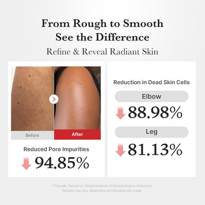 medicube Body Peel Shot with Hypochlorous Acid | Gentle Body Exfoliating Serum for Dead Skin Cells, Rough Patches &amp; Uneven Texture | Rice Extract, Panthenol for Hydrating &amp; Smoothing Care | 9.46 fl.oz