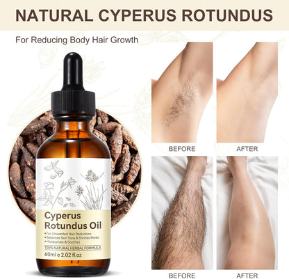 Premium Cyperus Rotundus Oil - Natural &amp; Effective Hair Removal Solution | 100% Pure Cyperus Rotundus Essential Oil for Smooth Skin | Anti-Hair Growth, Nourishing Treatment for Sensitive Skin 60ML
