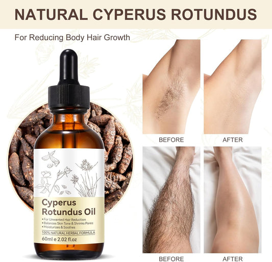 Premium Cyperus Rotundus Oil - Natural &amp; Effective Hair Removal Solution | 100% Pure Cyperus Rotundus Essential Oil for Smooth Skin | Anti-Hair Growth, Nourishing Treatment for Sensitive Skin 60ML